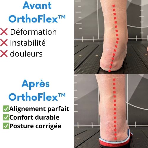 OrthoFlex™ – Semelles Orthopédiques Révolutionnaires