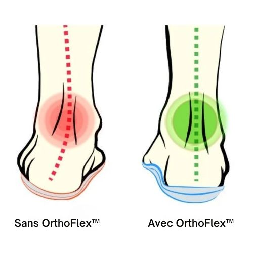 OrthoFlex™ – Semelles Orthopédiques Révolutionnaires